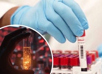 বিশ্বে মাত্র ৫০ জনের শরীরে আছে ‘আরএইচ-নাল’ নামের রক্ত