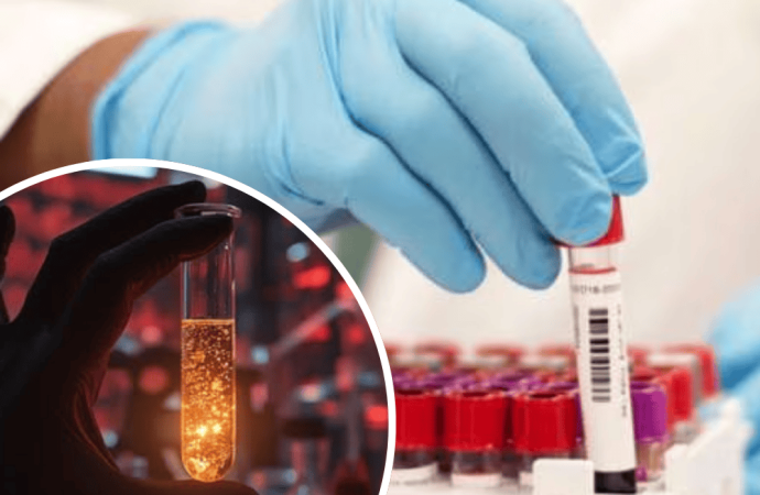 বিশ্বে মাত্র ৫০ জনের শরীরে আছে ‘আরএইচ-নাল’ নামের রক্ত