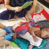 টিকা নেওয়ার বয়স হওয়ার আগেই হামে ৬১ শতাংশ শিশুর মৃত্যু, বয়সসীমা এগিয়ে আনা নিয়ে এখনও সিদ্ধান্তহীন সরকার