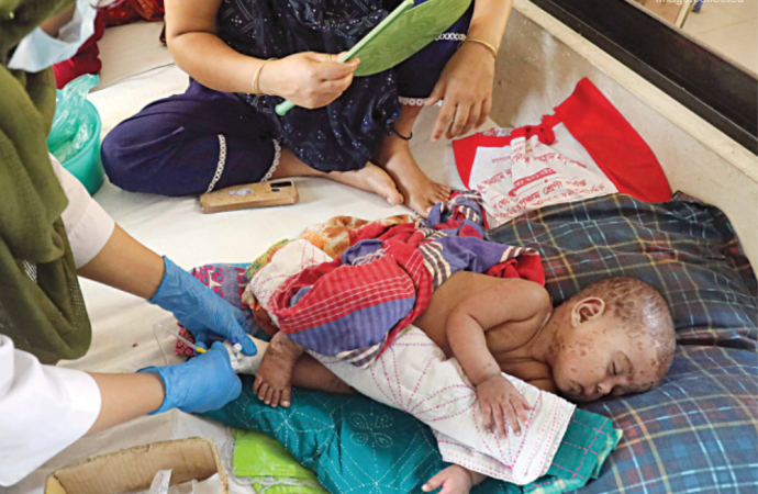 টিকা নেওয়ার বয়স হওয়ার আগেই হামে ৬১ শতাংশ শিশুর মৃত্যু, বয়সসীমা এগিয়ে আনা নিয়ে এখনও সিদ্ধান্তহীন সরকার